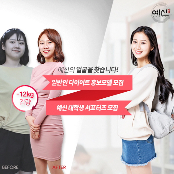 예신다이어트, 일반인 모델&대학생 서포터즈 모집 74-Image